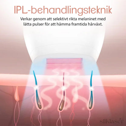 Vad sägs om bara 1 till Silklaser IPL Hårborttagning för endast 399 kr?