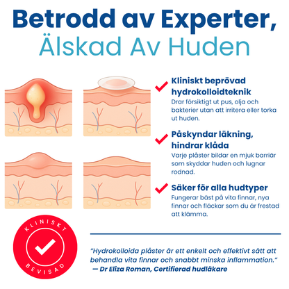 AcneFix™ Pimple Patch