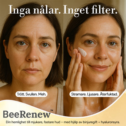 BeeRenew™ Lyftande