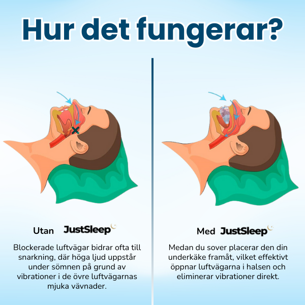JustSleep™ Snarkskena