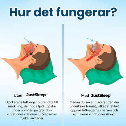 JustSleep™ Snarkskena