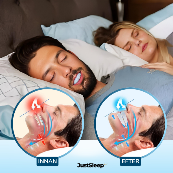 JustSleep™ Snarkskena