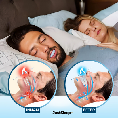 JustSleep™ Snarkskena
