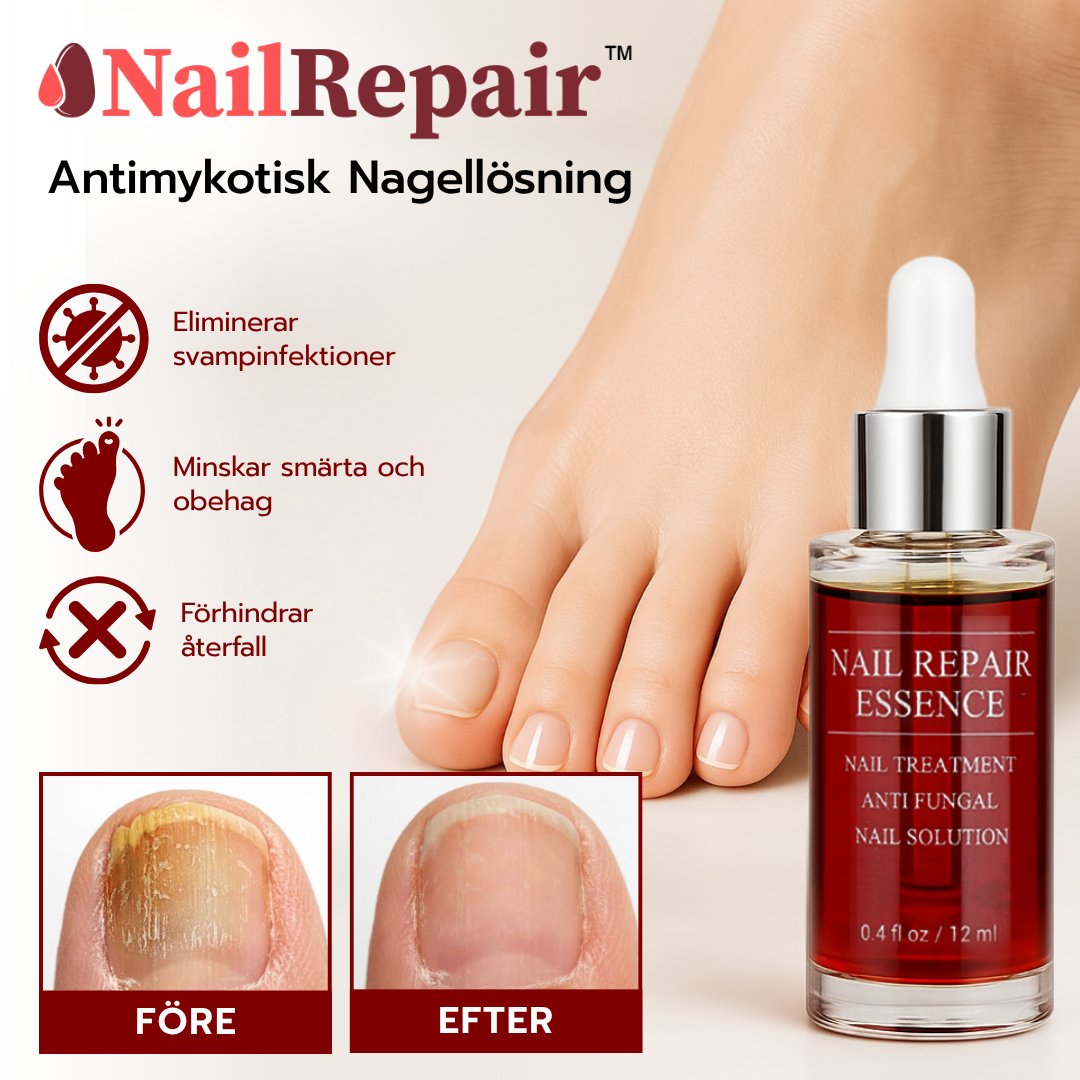 NailRepair™ Antimykotisk Nagellösning