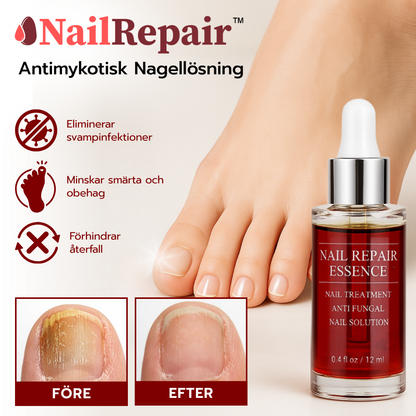 NailRepair™ Antimykotisk Nagellösning