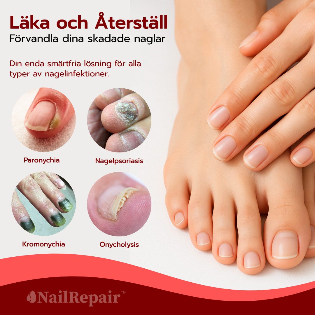 NailRepair™ Antimykotisk Nagellösning