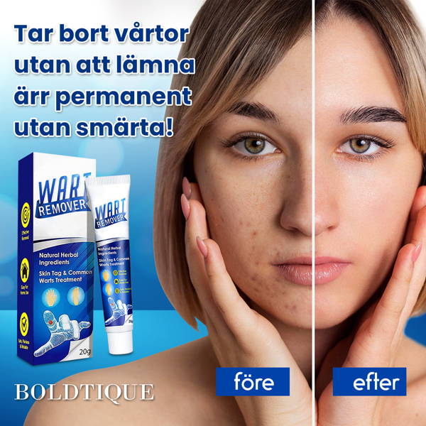 Boldtique Vårtborttagningskräm